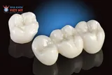 Nha khoa Việt Mỹ bật mí nên bọc răng sứ loại nào tốt và an toàn