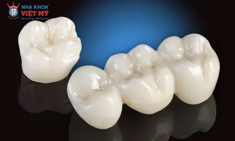 Nha khoa Việt Mỹ bật mí nên bọc răng sứ loại nào tốt và an toàn