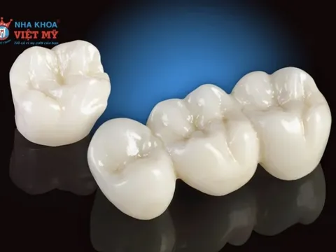 Nha khoa Việt Mỹ bật mí nên bọc răng sứ loại nào tốt và an toàn
